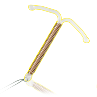 Спираль внутриматочная "Юнона" Био-Т Super Т-образной формы